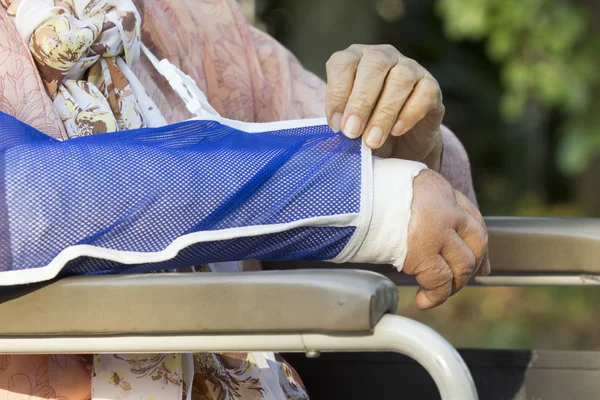 Senior woman with a broken arm on a plaster cast — Stock Photo, Image