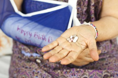 kırık kol kıdemli kadın evde ona hapları