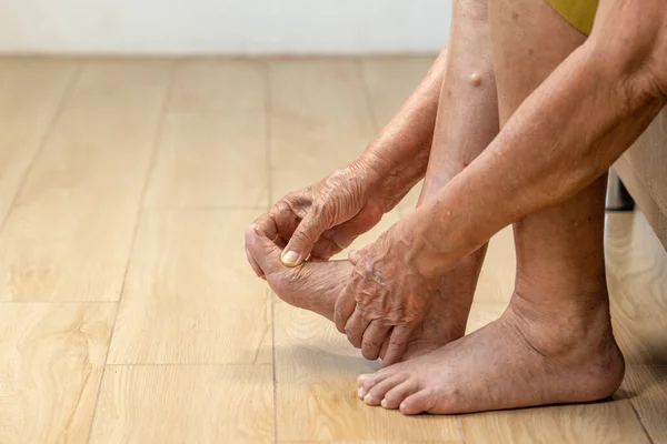 Oudere Vrouw Masseren Haar Voet Met Pijnlijke Gezwollen Jicht Ontsteking — Stockfoto