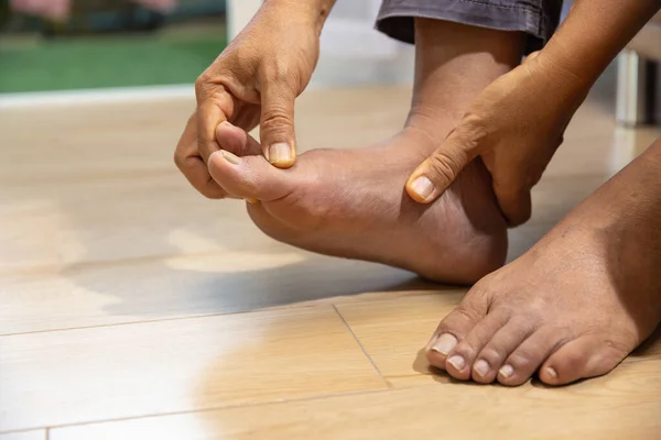 Senior Man Massagem Com Dor Inchada Gota Inflamação — Fotografia de Stock