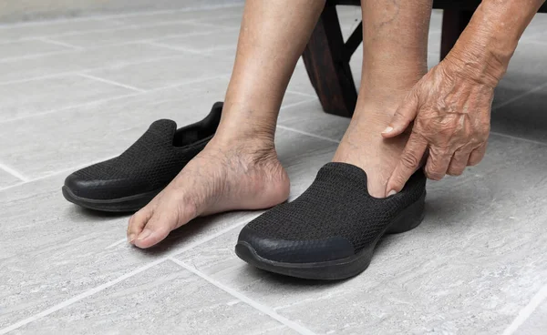 Starší Žena Křečové Žíly Nohy Dává Boty Doma — Stock fotografie