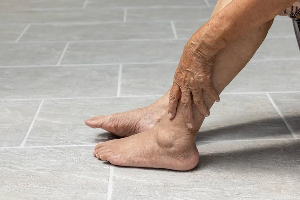 Elderly Woman Massage Her Foot Painful Swollen Gout Inflammation — Stock Photo, Image