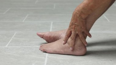Yaşlı kadın masajı varis ve şişmiş ayaklar.