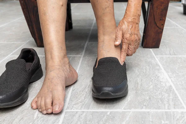 Oudere Vrouw Spataderen Voeten Zet Een Schoenen Thuis — Stockfoto