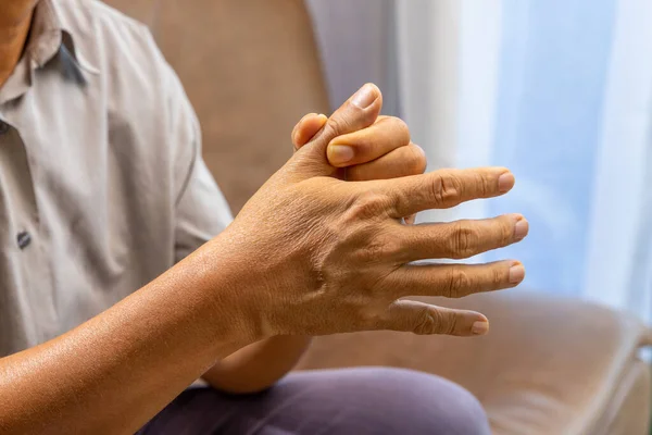 Oudere Man Hand Die Last Heeft Van Gewrichtspijn Met Jicht — Stockfoto