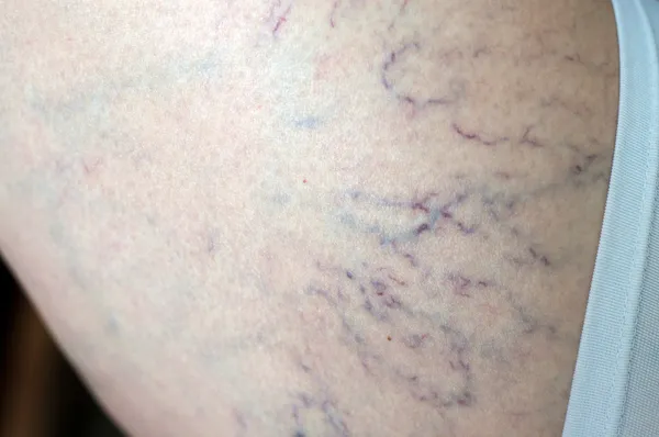 yaşlı kadın ile varis