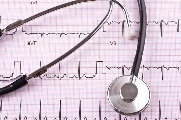Stethoscope and heart cardiogram — Stock Photo, Image