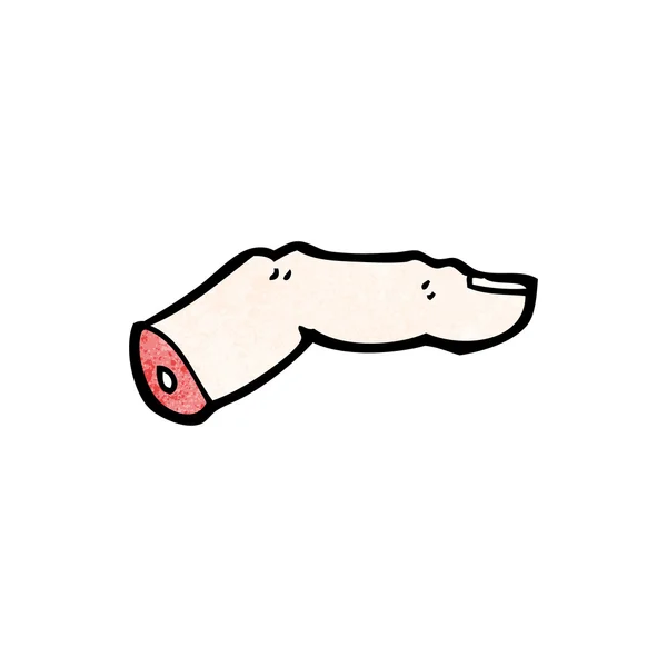 Avkuttet finger – stockvektor