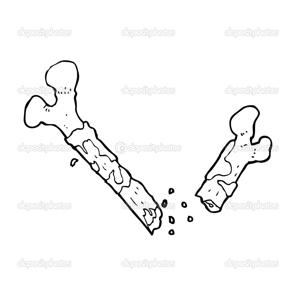 Gross broken bone cartoon Stock Vector Image by ©lineartestpilot #38441355 Gross broken bone cartoon Stock Vector Image by ©lineartestpilot #38441355
