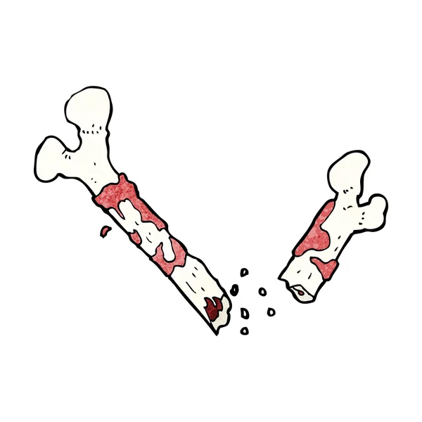 Desenhos animados de ossos partidos — Vetor de Stock