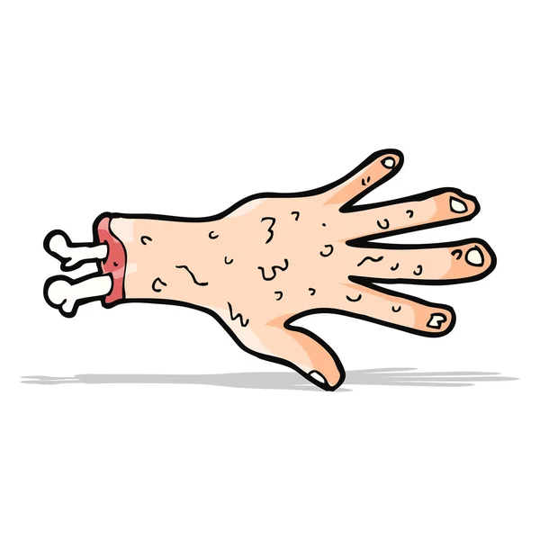 Karikatur einer stark abgetrennten Hand — Stockvektor