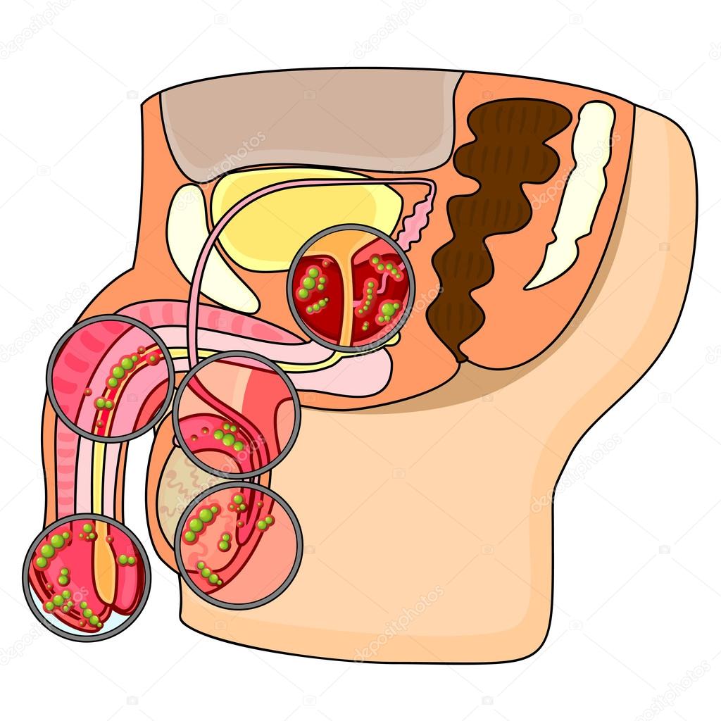 Diseases of male reproductive system