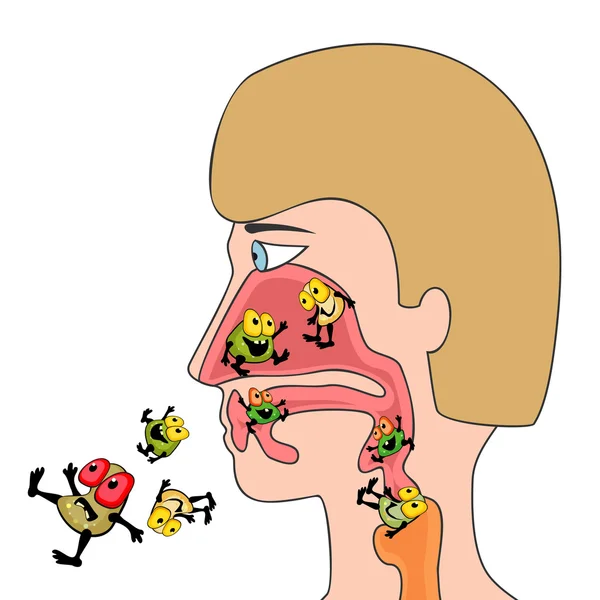 Infecties van de luchtwegen — Stockvector