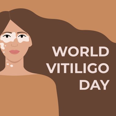 Dünya Vitiligo Günü 25 Haziran kare pankartı. Vitiligo cilt hastalığı olan bronz tenli bir kadın. Vücut pozitif. Düz vektör illüstrasyonu