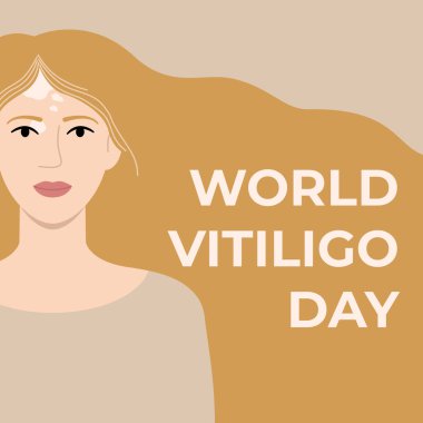 Dünya Vitiligo Günü 25 Haziran kare pankartı. Vitiligo deri hastalığı olan beyaz bir kadının yüzü. Vücut pozitif. Düz vektör illüstrasyonu