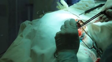 işlem. cerrahi masa. implantasyon