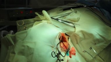 işlem. cerrahi masa. implantasyon