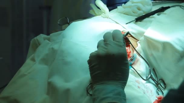 Operatie. chirurgische tabel. implantatie — Stockvideo