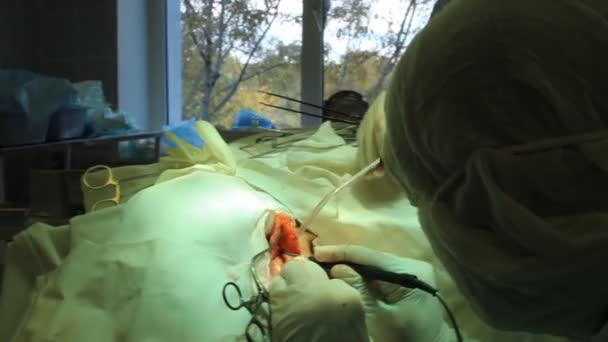 Operation. Operationstisch. Implantation — Stockvideo