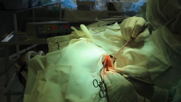 Operation. Operationstisch. Implantation — Stockvideo