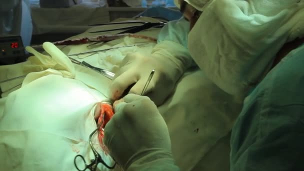 Operation. Surgical table. implantation — Stock Video
