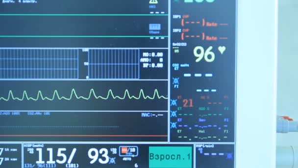 ECG monitor in operatie kamer — Stockvideo