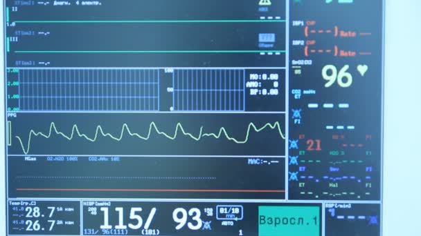 Moniteur ECG en salle d'opération — Video