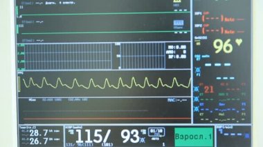 operasyon odasında EKG monitör