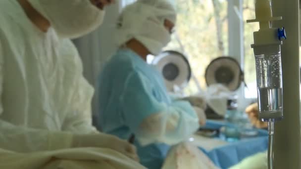 Operazione. Tabella chirurgica — Video Stock