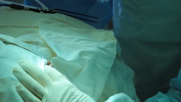 Operazione. Tabella chirurgica — Video Stock