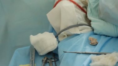 işlem. cerrahi masa. implantasyon. Rusya