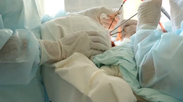 操作。外科的表。植入术。俄罗斯 — 图库视频影像