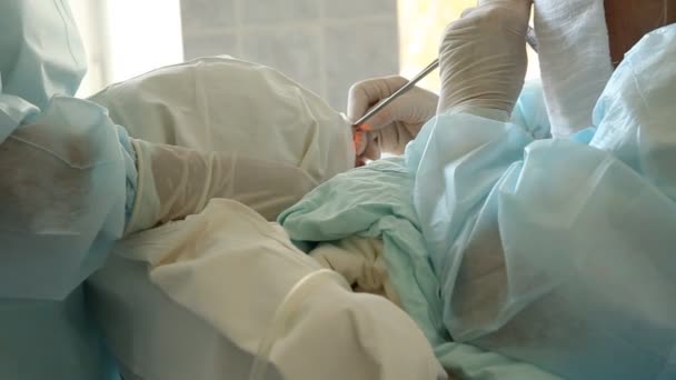 Operação. Mesa cirúrgica. implantação. Rússia — Vídeo de Stock