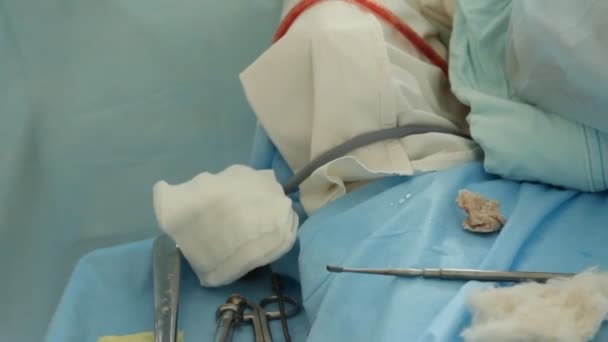 Операция. Хирургический стол. имплантация. Россия — стоковое видео