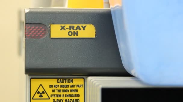 Röntgen inspektionssystem. bagage på flygplatsen — Stockvideo