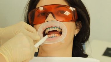 diş beyazlatma. Diş elektrikli süpürge. stomatology