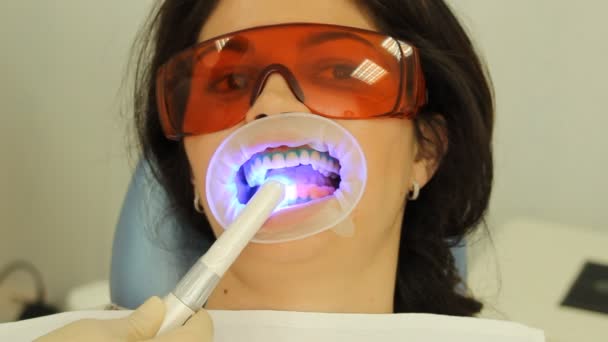 Tanden whitening. de activeringsprocedure van het gel polymerisatie licht. Afdeling Stomatologie — Stockvideo
