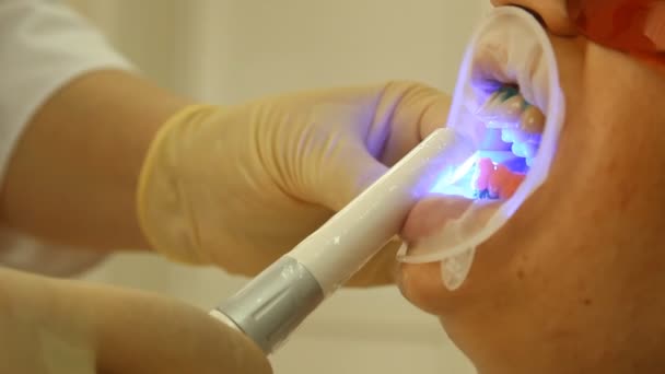 Branqueamento dos dentes. Ativação da luz de polimerização do gel. estomatologia — Vídeo de Stock