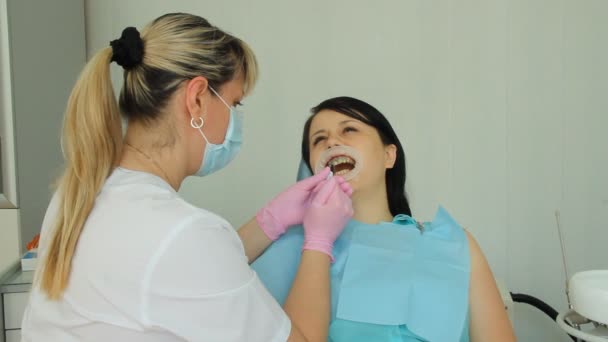Teeth Whitening. Insulation gel soft tissue — Stock Video