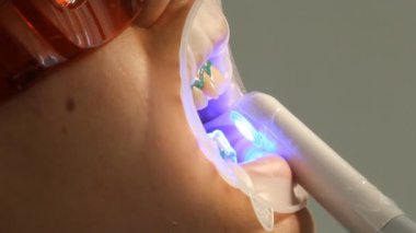 Diş Hekimliği Diş beyazlatma