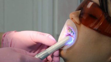 Diş Hekimliği Diş beyazlatma