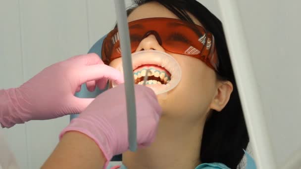 Tandblekning tandvård — Stockvideo