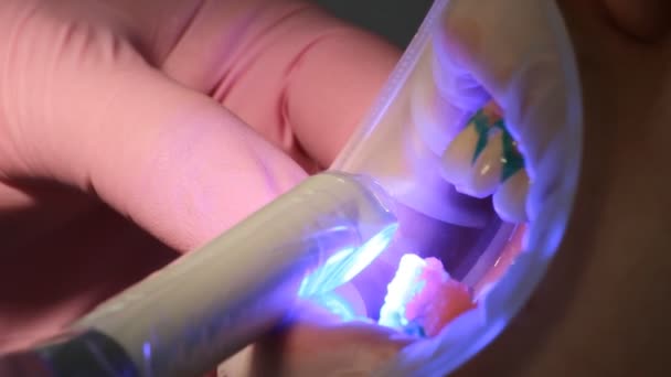 Tanden whitening tandheelkunde — Stockvideo