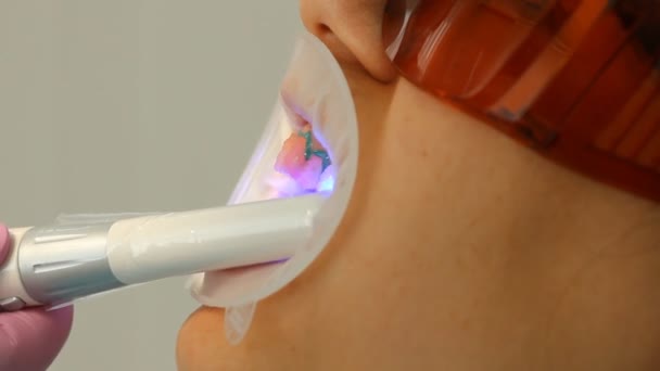 Denti sbiancamento odontoiatria — Video Stock