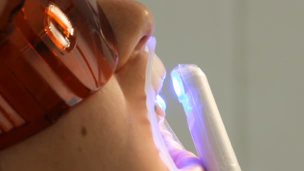 Stomatologia wybielanie zębów — Wideo stockowe