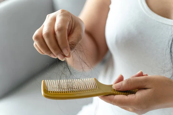 Hair fall problem. Asian woman with comb and hair problem. Hair loss from comb. Hair care and beauty concepts.