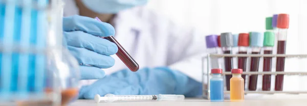 Forskare Testar Antiretrovirala Läkemedel Från Blodet Hos Infekterade Patienter För — Stockfoto