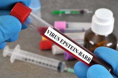 Epstein-Barr virüs testi konsepti. Kan tüpü eldiven ile tutuluyor. Yakın çekim.