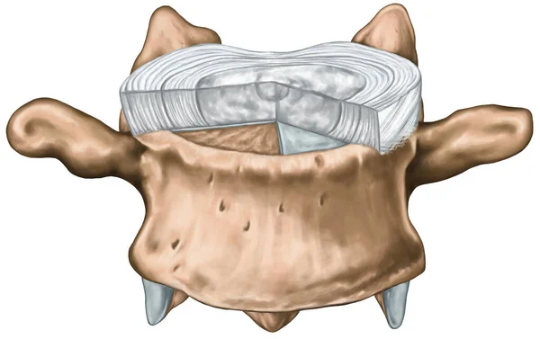 Structure Intervertebral Disk Outer Inner Zone Anulus Fibrosus Hyaline Cartilage Zdjęcie Stockowe