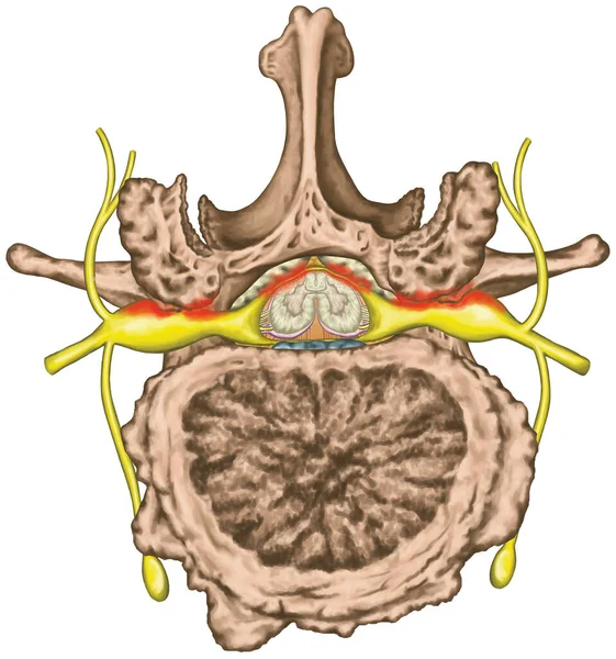 Central Lateral Stenosis Second Lumbar Vertebra Nervous System Spinal Cord — Stock Fotó